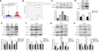 Rab12 Promotes Radioresistance of HPV-Positive Cervical Cancer Cells by Increasing G2/M Arrest